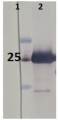 Lhcb1 | LHCII type I chlorophyll a/b-binding protein (Arabidopsis specific)